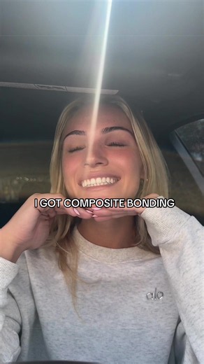 Composite Bonding Before and After: What to Expect at Atlanta Dental Spa
