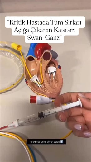Hemşirolog | EĞiTiM& SAĞLIK&VAKA & AKADEMİ | ✨ Swan–Ganz Kateteri Nedir? Kritik hastalarda hemodinamik durumu en detaylı şekilde değerlendirmek için kullanılan özel bir kateterdir.... | Instagram