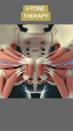 What is V-Tone Procedure and How It Works? (3D Animation) #vtonetreatment #vtonesurgery 23.1K #rejuvination #tightening #musclestightening #pelvicfloor #vtoneinsertion #medical3danimation #3dmedicalanimation