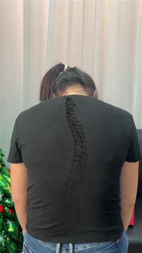 Start Correcting Your Posture for Better Health