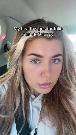 My health signs for folic acid deficiency! I was diagnosed in January and still having these symptoms even though I’m on 5mg tablets ahhhh help! #fyp #foryouhealth #healthcheck #folicacid #folicacidsupplementation #folicacidawareness #folicaciddeficiency #jodiemoon