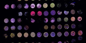 Multiplexed Spatial Proteomics Services: Phenocycler aka CODEX