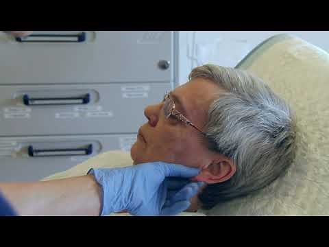 Capillary sampling on adults for blood gas analysis