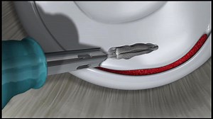 Anterior Labral Repair Using Y-Knot Flex