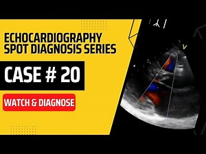 Case 20: Echocardiography Spot Diagnosis Case Series #echocardiography #echo #cardiology