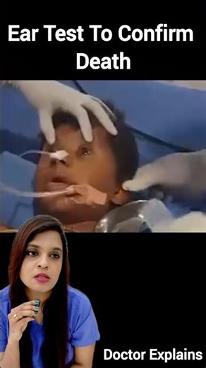 Ear Test to confirm Death #drnalliramya #skincare #ent #ramicos #vizagent #death #hair #vizagdoctor