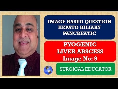 PYOGENIC LIVER ABSCESS- Hepato Biliary Pancreatic Image 9