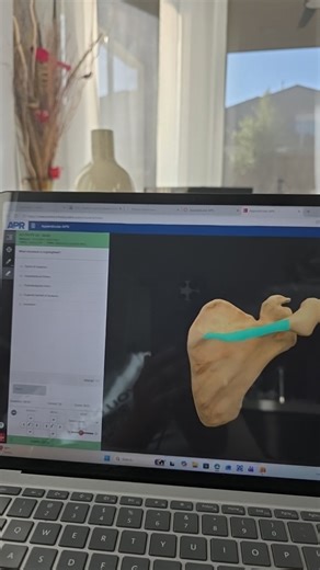 What structure is highlighted?  A. Spine of scapula B. Supraspi... | Filo