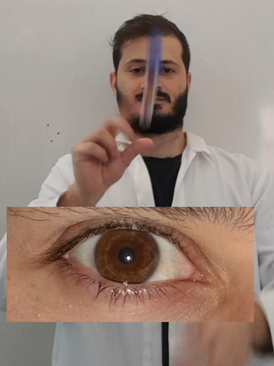 معلومات طبية عن العين