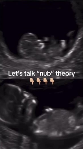 That’s Not a Boy…