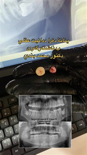 فيديوهات أنشأها Dr.Mohammed.Bandi (@dr.mohamed.bandi) باستخدام original sound - Dr.Mohammed.Bandi