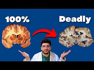 The Most FATAL Disease (A Patient Story)