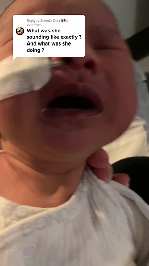 Understanding Pierre Robin Sequence and Trachea Tug in PRS Baby Brenda M Diaz