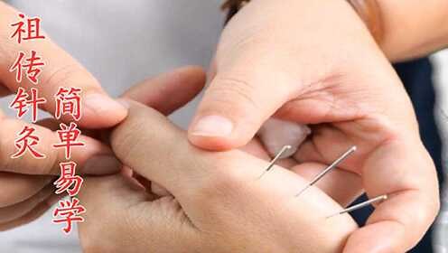 针灸实操教学视频，全120集（第十一集）