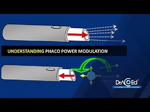 24 | Prof.Venkatesh | Understanding Phaco power modulation