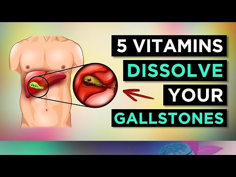 5 Vitamins To DISSOLVE Your GALLSTONES