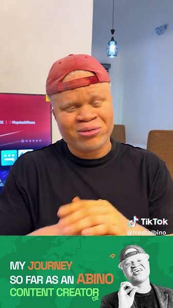 Journey of an Albino Content Creator