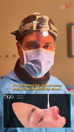 Behind the Scenes: A Day in Rhinoplasty with Assoc. Prof. Dr. Güncel Öztürk
