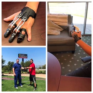 MCP Driver, from Naked Prosthetics, at Scott Sabolich Prosthetics in OKC. | Scott Sabolich Prosthetics Ottobock.care