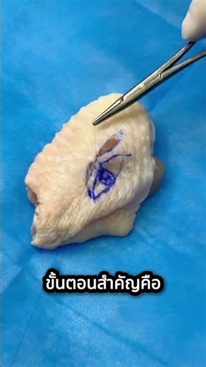 Simulating the process of creating double eyelids using chicken wings.