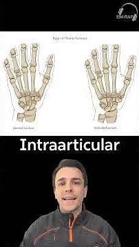 Thumb Fractures