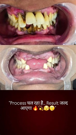 “Process चल रहा है… Result जल्द आएगा 🔥”