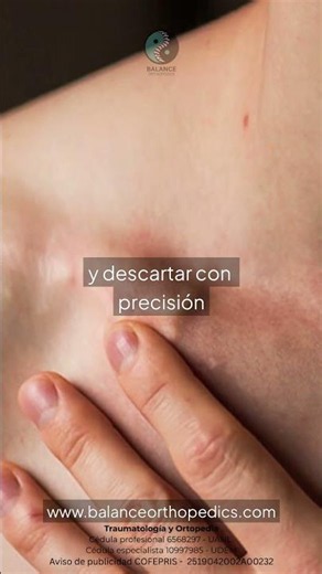 🦴 Did you fracture your collarbone without displacement? Here is what you need to know.