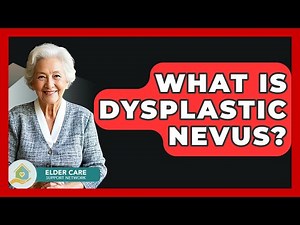 What Is Dysplastic Nevus? - Elder Care Support Network