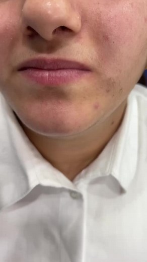 Dental Exam Tools: Close-Up Mouth Examination