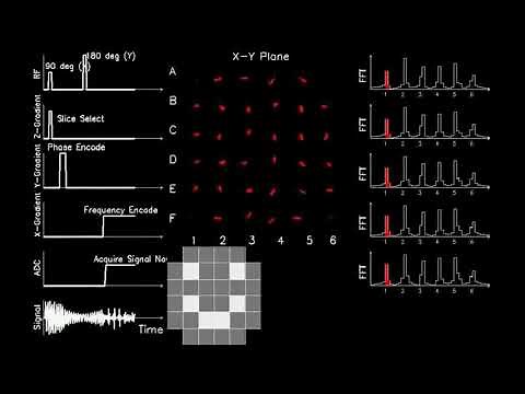 MRI: Physics and Image Creation - 2D Image Acquisition Example (Part 18/18)