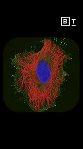 2.4K views · 1.9K reactions | When AI meets biology ️ “Over the next 20 years, we’re going to see profound changes in how we do science.” Our Head of Science Steve Quake explains how we’re applying AI to biology to help scientists end disease as we know it. | Biohub | Facebook