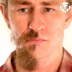 281K views · 742 reactions | Watch the wound healing timelapse and more Partner: Kolo / Time Lapse YT: https://www.youtube.com/@KoloTimeLapse/videos | Crafty Panda | Facebook