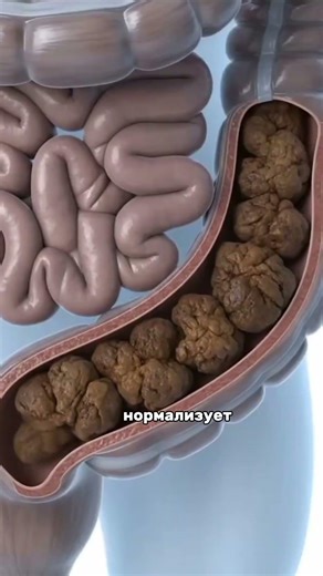 Sound familiar? I'm sharing the product number for the original probiotic, #WW297159 (copy from WW)