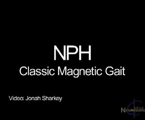 NPH Gait, pre-surgery