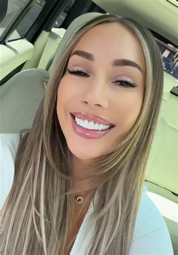 @Dr. Daniel Sluyk, DDS the best in the game! From composite bonding —> porcelain. NOT INVASIVE. My teeth are still underneath