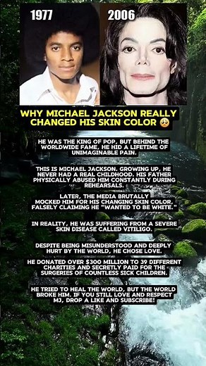 Why Michael Jackson Really Changed His Skin Color 🥺
