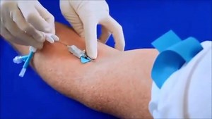 Cateter Nexiva 😱 O sistema de cateter fechado BD Nexiva foi concebido para minimizar os ferimentos causados por punção de agulhas e exposição a sangue durante a introdução. O cateter permite maior tempo de permanência e que se torna flexível quando em contato com a corrente sanguínea, reduzindo a ocorrência de flebite em até 50%. | No Caminho da Enfermagem