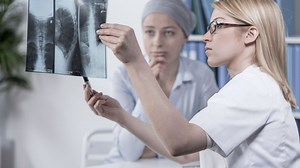 Les traitements des cancers du poumon