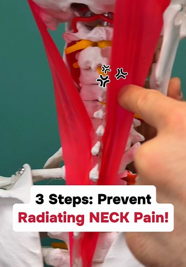 Relieve Neck Pain with Splenius Capitis Techniques