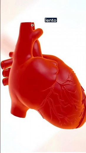 Cardiac Arrhythmias