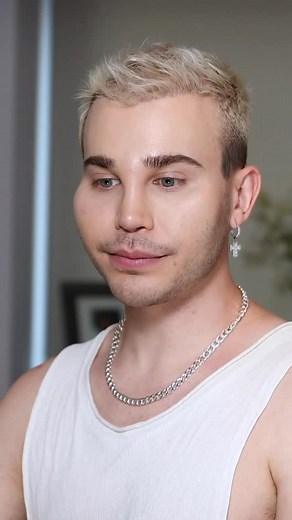 1.1M views · 2.5K reactions | Engineering ⚒️ I look back at some of the choices I made when I was younger, and though they taught me many valuable lessons and I achieved what I was aiming for at that moment in time, I feel and look much happier and healthier. Speculations are equally as unhealthy but here’s a real, raw and realistic presentation of what 20ml of filler around the face looks like vs zero filler and damage repair | Alexis Stone | Facebook