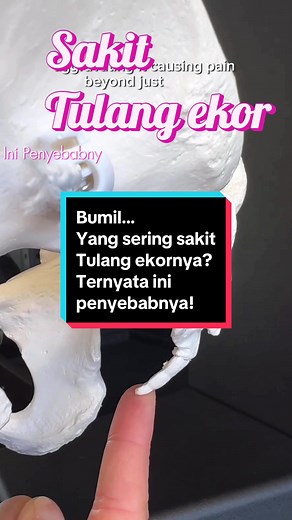 Mengatasi Nyeri Tulang Ekor Saat Hamil: Tips dan Edukasi