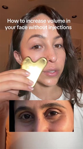 There are many ways to bring back volume out of your eyes, but using value filling is actually the dream combo with a shot because you’re building the fat up while also flattening out the area at the same time, I’ve used many others, but the one from @mimmua is the best 🤍 #undereyebags #undereye