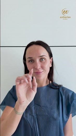 Simple Procedure, Stunning Results – Forehead Reduction in Istanbul 👩‍⚕️