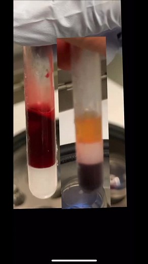 The part 2 of what we do with your blood! Rep to @melak_36 #tiktokwellness #learnontiktok #science #blood #learn #hacks