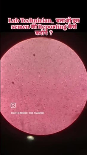 semen analysis microscopy view #lab #labtechnician #medicalstudent
