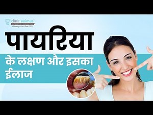 Pyorrhea Ka ilaj | Gum Problems In Teeth | Pyorrhea Prevention & Treatment | Best Dentist In Delhi