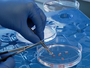 In Vitro Differentiation of Human Mesenchymal Stem Cells into Functional Cardiomyocyte-like Cells