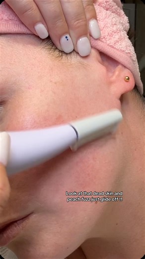 Michael Todd Beauty | Dermaplaning with Sonicsmooth ft. @kimkayephotography How to dermaplane with Sonicsmooth: 1. Cleanse skin & Pat dry 2. Place a new... | Instagram