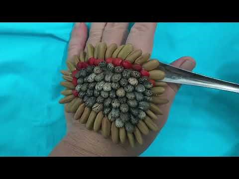 【閲覧注意】ダニ除去 集合体恐怖症